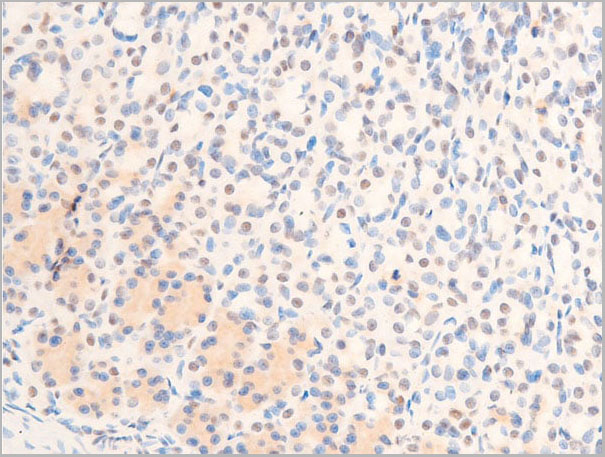 product-image-AAA30982_IHC9.jpg