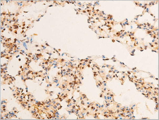 product-image-AAA30983_IHC3.jpg