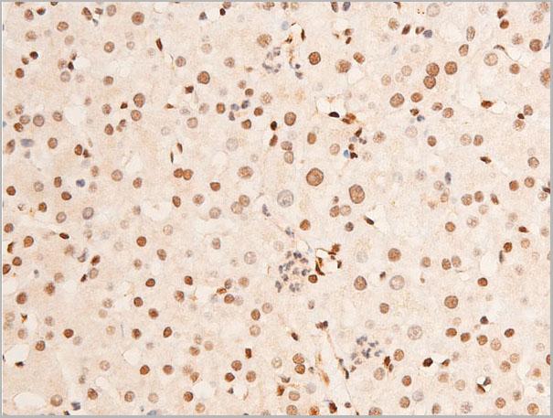 product-image-AAA30983_IHC5.jpg