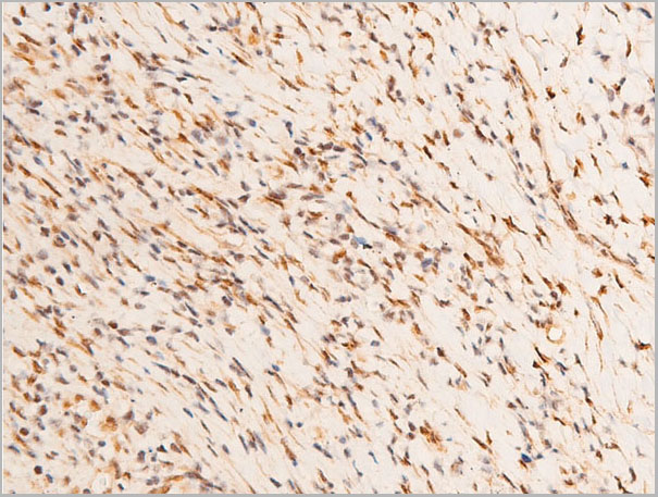 product-image-AAA30983_IHC6.jpg