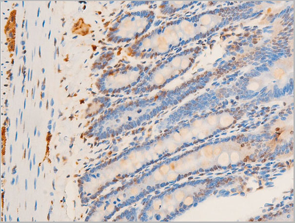 product-image-AAA30983_IHC9.jpg