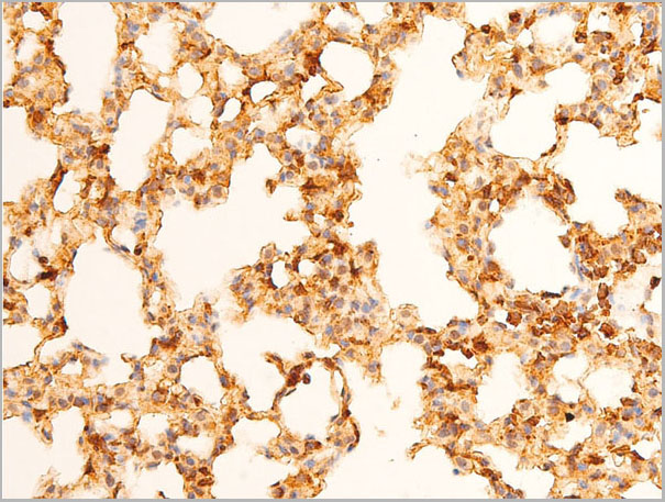 product-image-AAA30984_IHC3.jpg