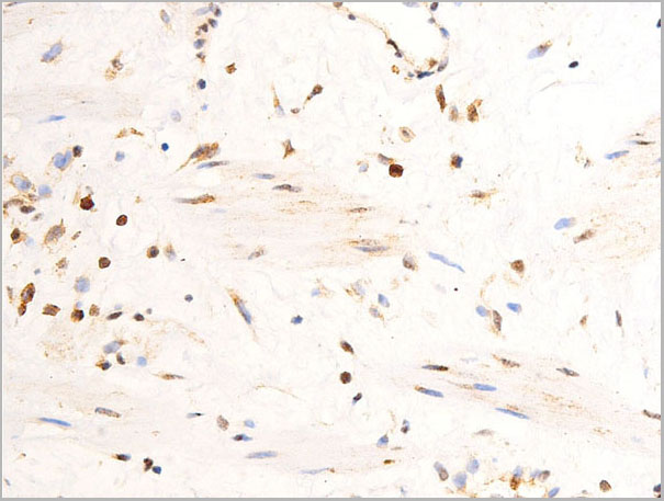product-image-AAA30984_IHC4.jpg