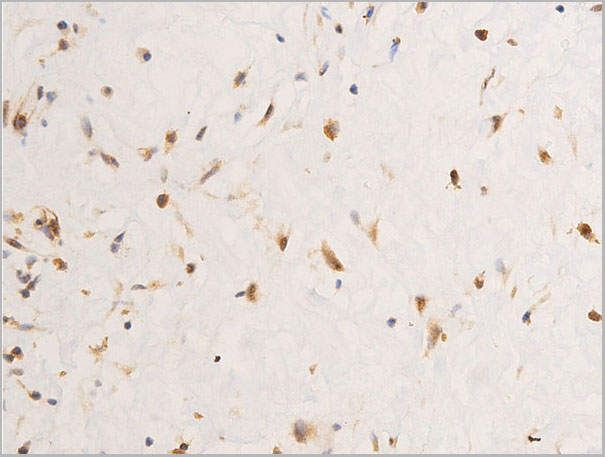 product-image-AAA30984_IHC6.jpg