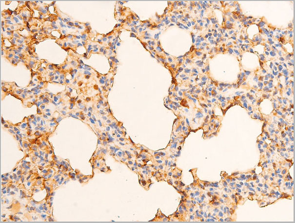 product-image-AAA30984_IHC8.jpg