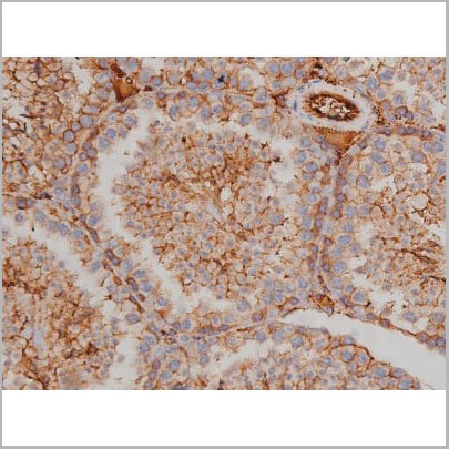 product-image-AAA30986_IHC14.jpg