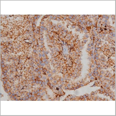 product-image-AAA30986_IHC15.jpg
