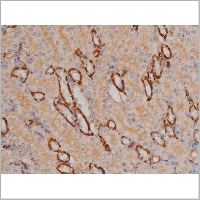 product-image-AAA30986_IHC16.jpg