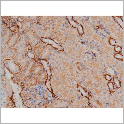 product-image-AAA30986_IHC17.jpg
