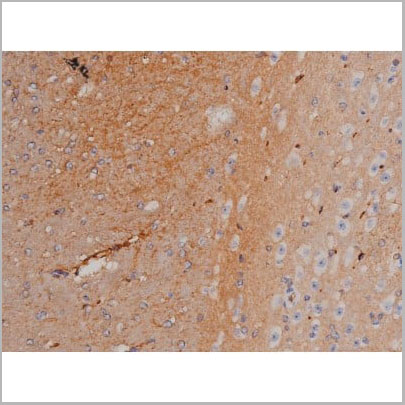 product-image-AAA30986_IHC18.jpg