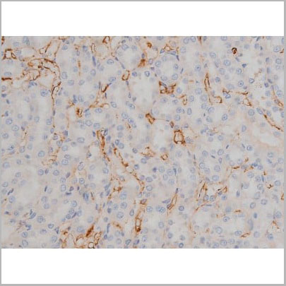 product-image-AAA30986_IHC19.jpg