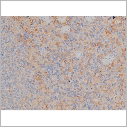 product-image-AAA30986_IHC20.jpg