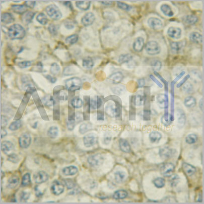 product-image-AAA30986_IHC3.jpg