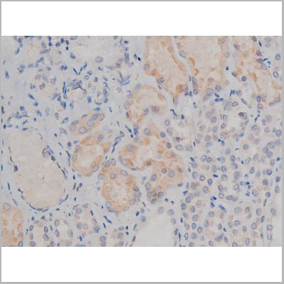 product-image-AAA30986_IHC5.jpg
