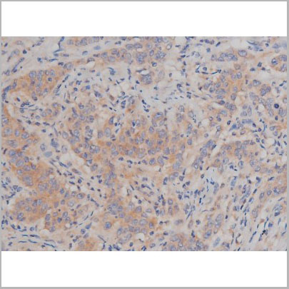 product-image-AAA30986_IHC6.jpg