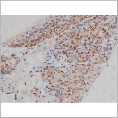 product-image-AAA30986_IHC8.jpg