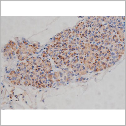 product-image-AAA30986_IHC9.jpg