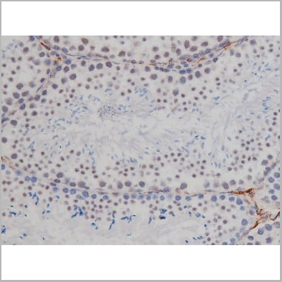 product-image-AAA30987_IHC10.jpg