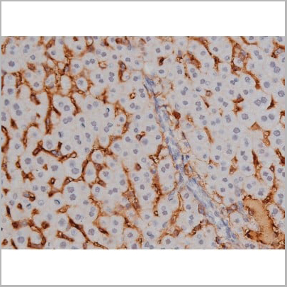 product-image-AAA30987_IHC13.jpg