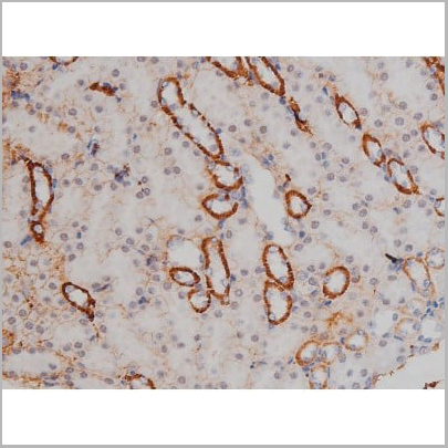 product-image-AAA30987_IHC14.jpg