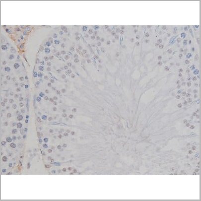 product-image-AAA30987_IHC16.jpg