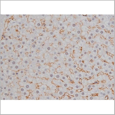 product-image-AAA30987_IHC17.jpg