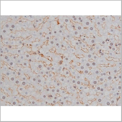 product-image-AAA30987_IHC18.jpg