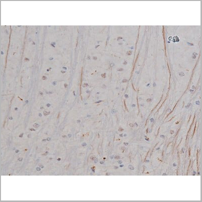 product-image-AAA30987_IHC19.jpg