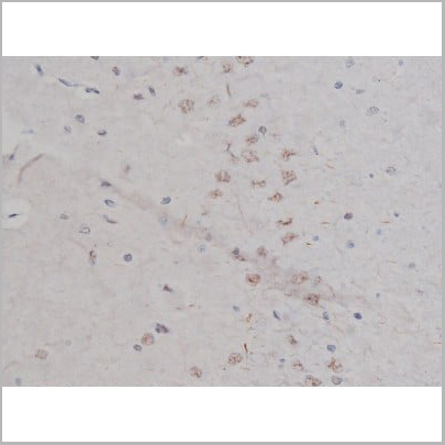 product-image-AAA30987_IHC20.jpg