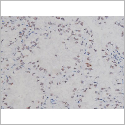 product-image-AAA30987_IHC4.jpg