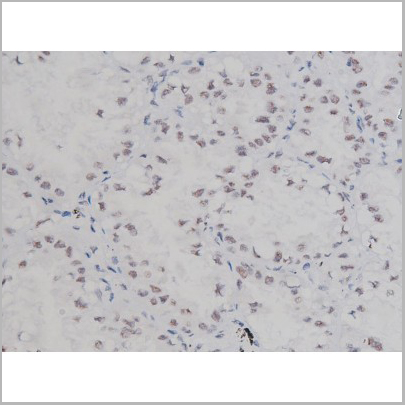 product-image-AAA30987_IHC5.jpg