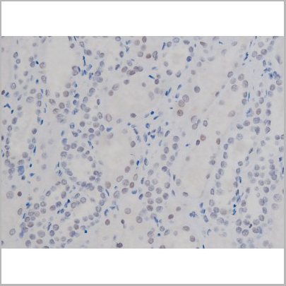 product-image-AAA30987_IHC6.jpg