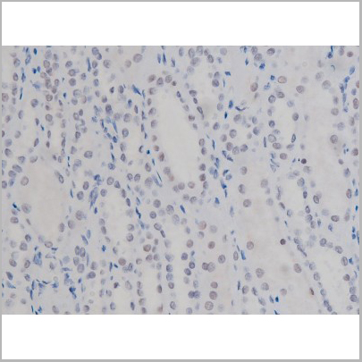 product-image-AAA30987_IHC7.jpg