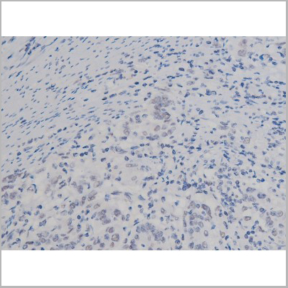 product-image-AAA30987_IHC8.jpg