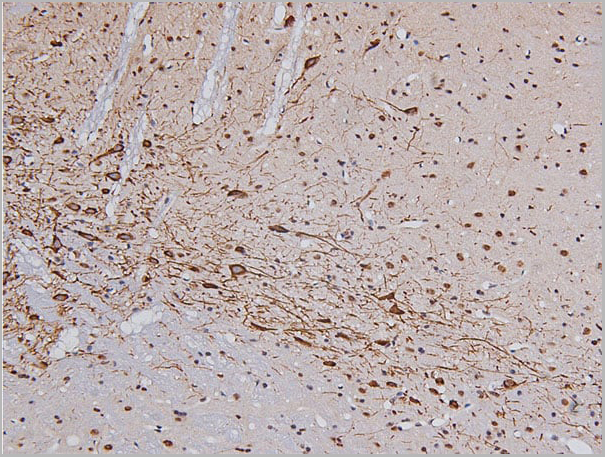 product-image-AAA30988_IHC2.jpg