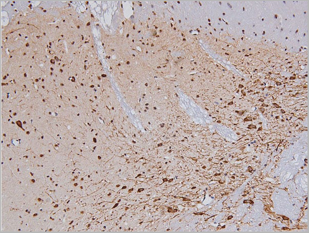 product-image-AAA30988_IHC3.jpg