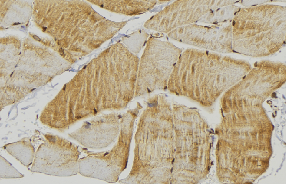 product-image-AAA30989_IHC5.jpg