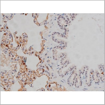 product-image-AAA30990_IHC12.jpg