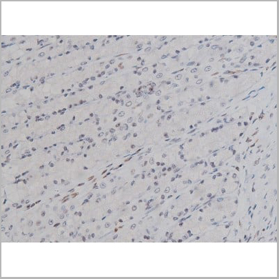 product-image-AAA30990_IHC14.jpg