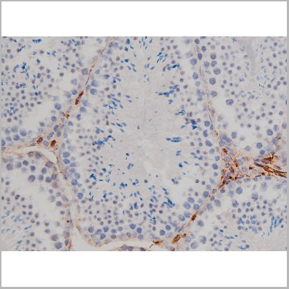 product-image-AAA30990_IHC2.jpg