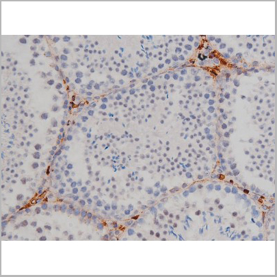 product-image-AAA30990_IHC3.jpg