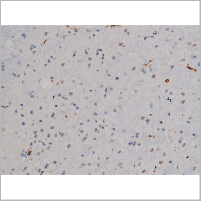 product-image-AAA30990_IHC4.jpg