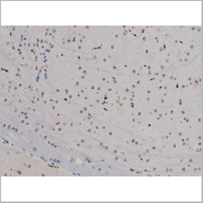 product-image-AAA30990_IHC5.jpg