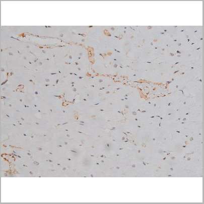 product-image-AAA30990_IHC8.jpg