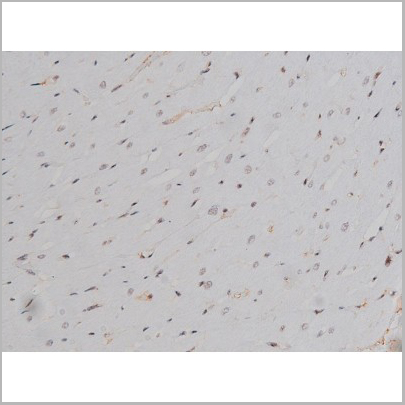 product-image-AAA30990_IHC9.jpg