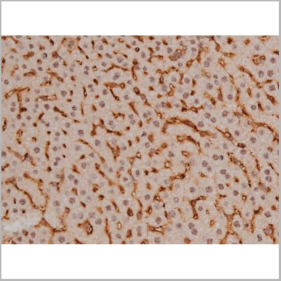 product-image-AAA30991_IHC11.jpg