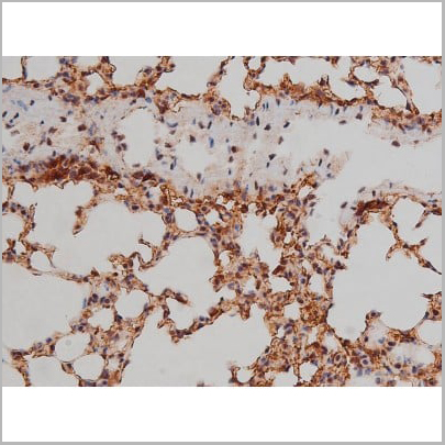 product-image-AAA30991_IHC14.jpg