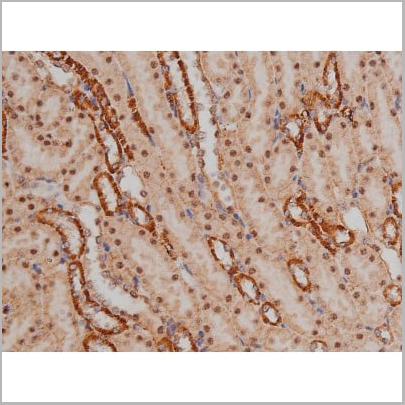 product-image-AAA30991_IHC15.jpg
