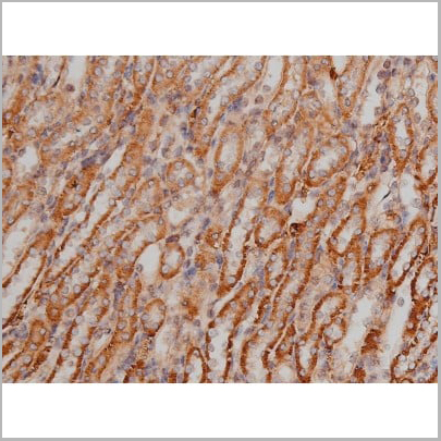 product-image-AAA30991_IHC16.jpg