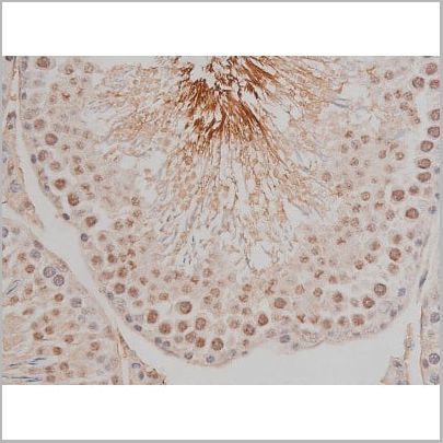 product-image-AAA30991_IHC17.jpg